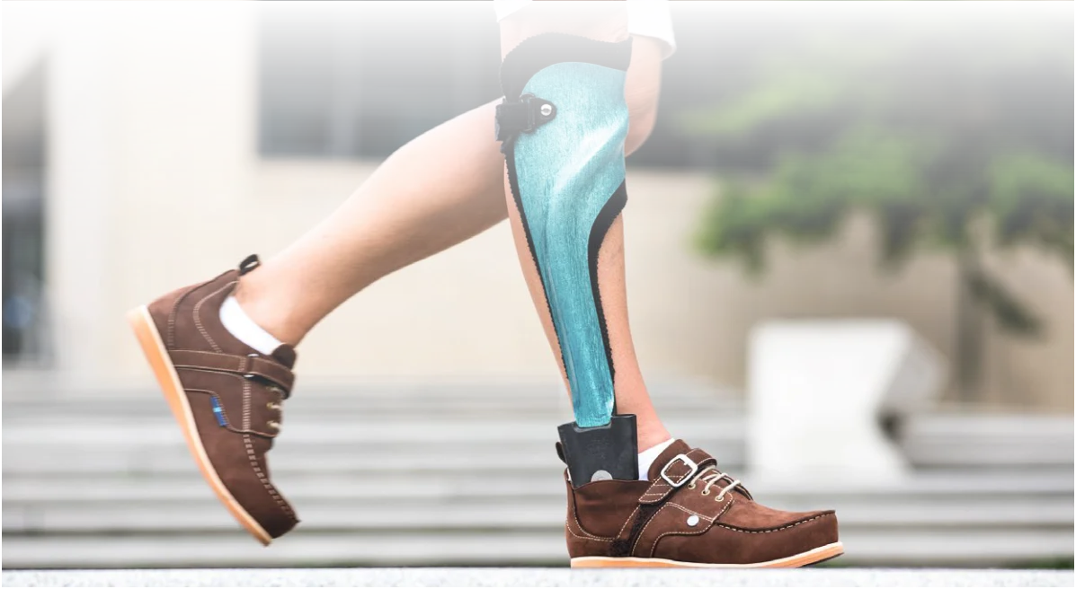 Custom orthotics and bracing at DakshinRehab physiotherapy clinic in Moosapet, Hyderabad