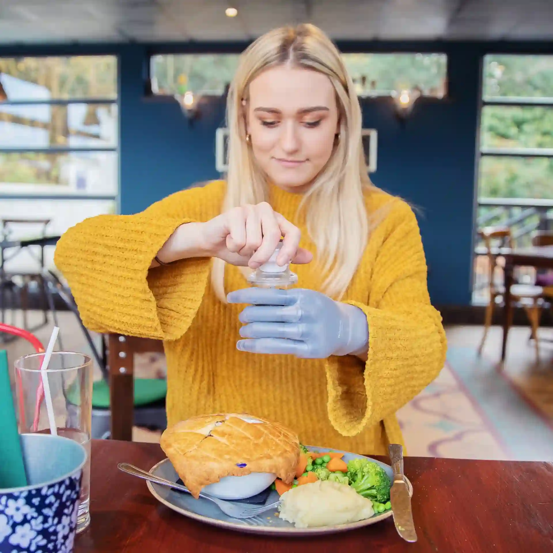 Cosmetic silicone prosthetic hand and upper limb restoration