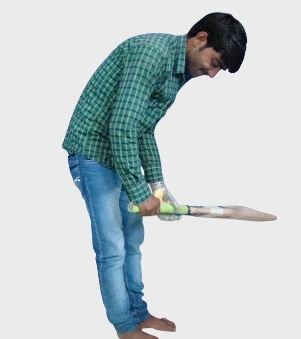 Myoelectric bionic hand sensors detecting residual limb muscle signals in Hyderabad