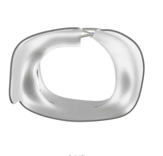 Cross-section of a Boston-type scoliosis brace showing symmetric trunk contact