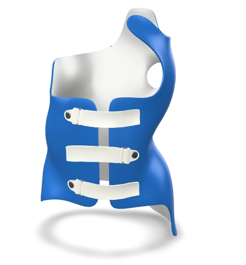 Front view of an asymmetric Chêneau-type three-dimensional scoliosis brace