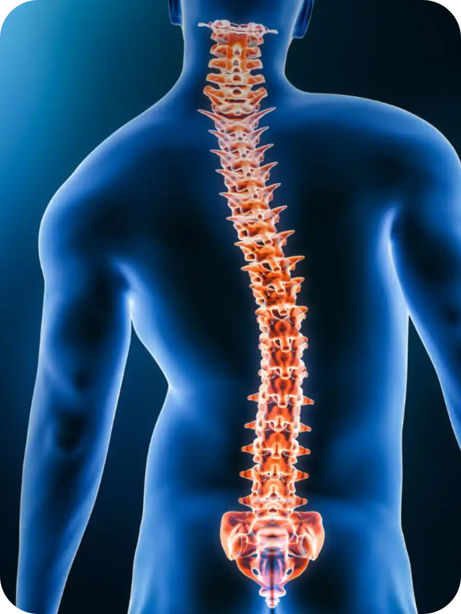 Child with scoliosis showing spinal curvature assessment at DakshinRehab Hyderabad