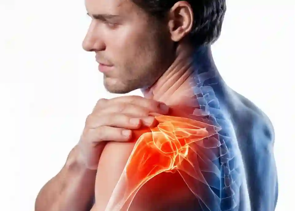 Cupping for shoulder pain