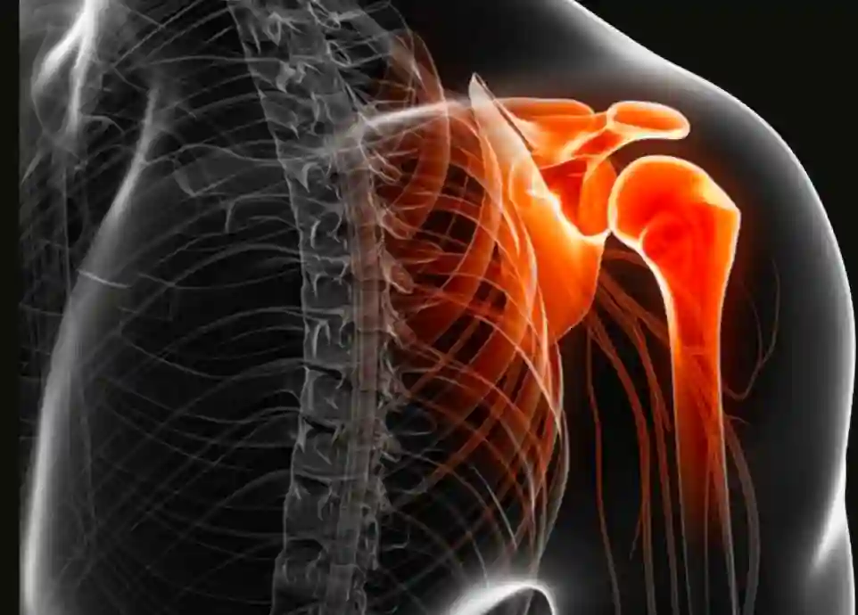 Shoulder Instability