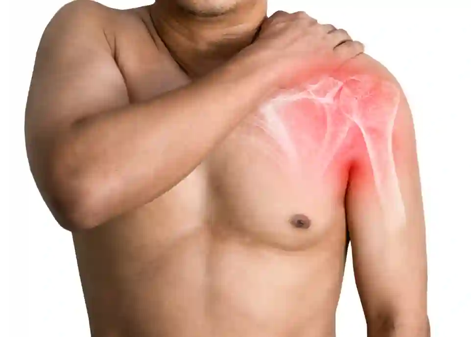 Cupping for athletic recovery