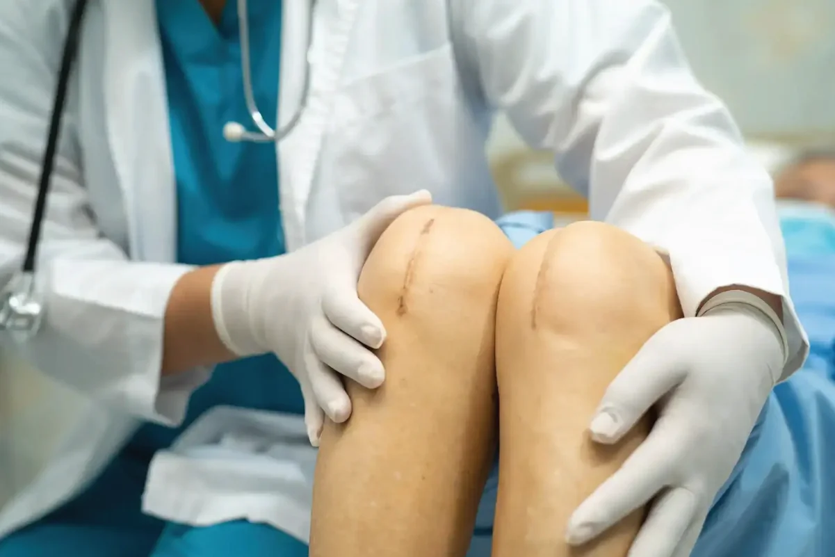 Total knee replacement physiotherapy at DakshinRehab Kukatpally