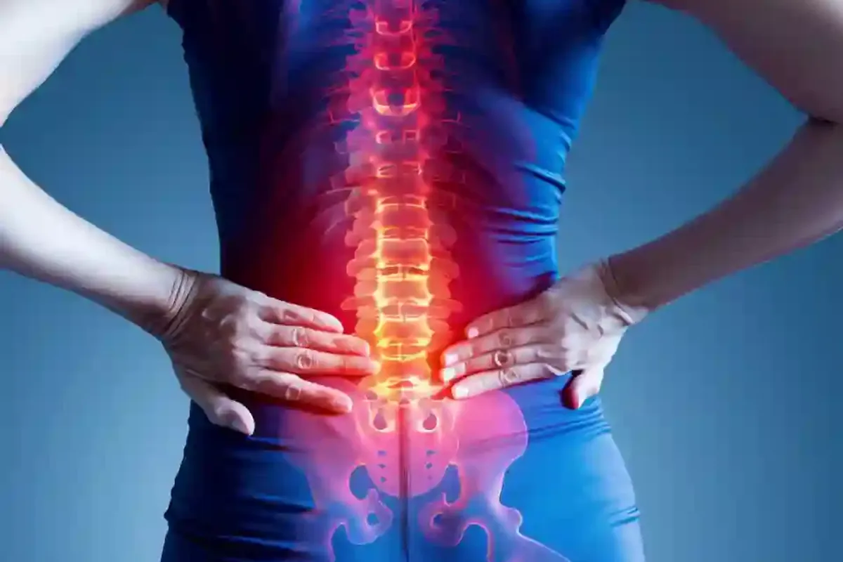 Cervical spondylosis physiotherapy Hyderabad