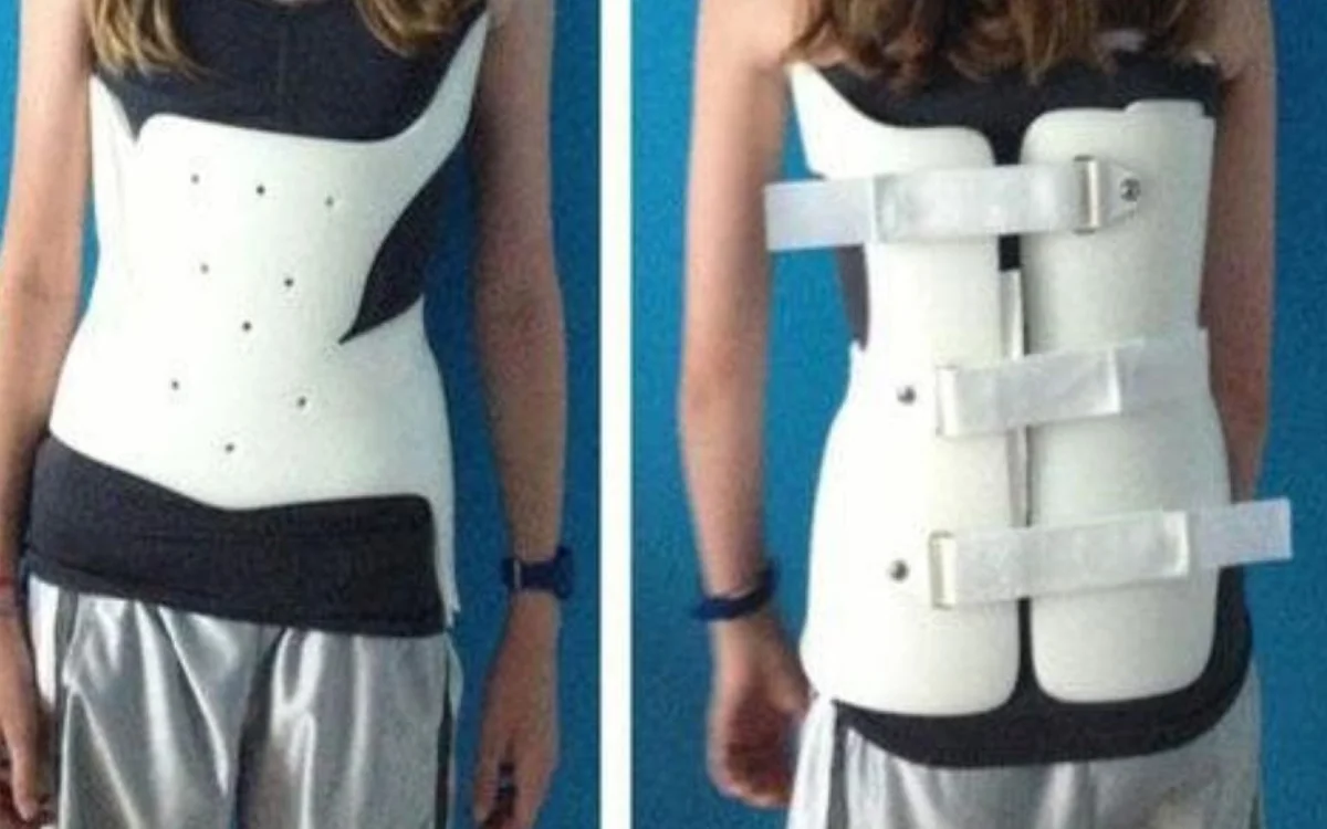 Custom spinal orthotics and bracing