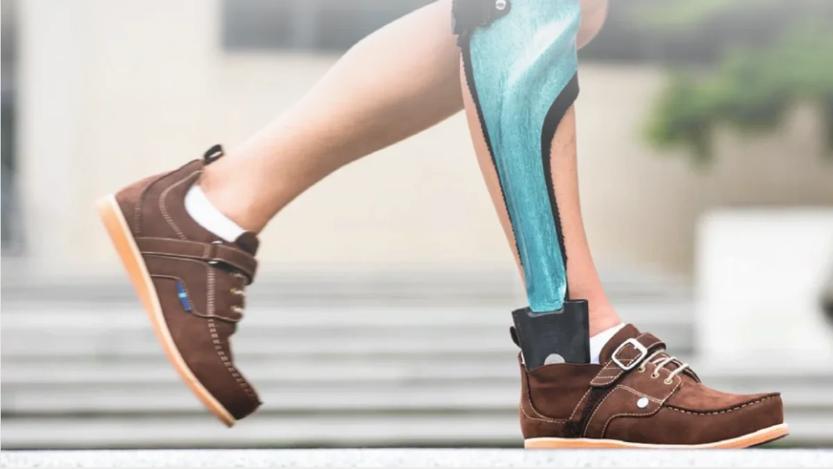 Gait Rehabilitation for Polio Orthotics & KAFO at DakshinRehab