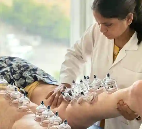 Therapeutic cupping cups on patient back