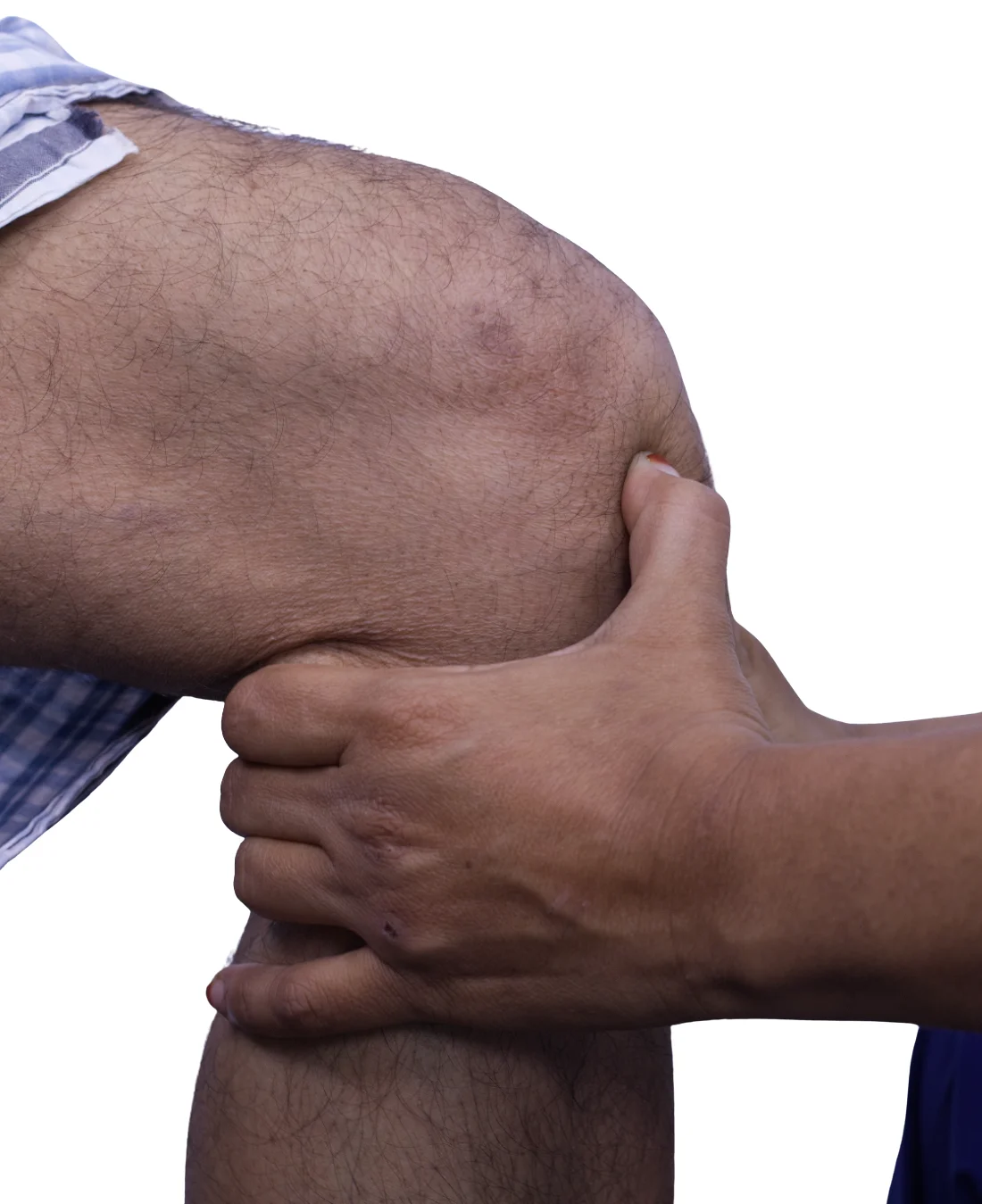 Stroke History & Walking Goals