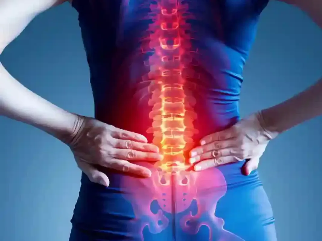 Cervical spondylosis physiotherapy Hyderabad
