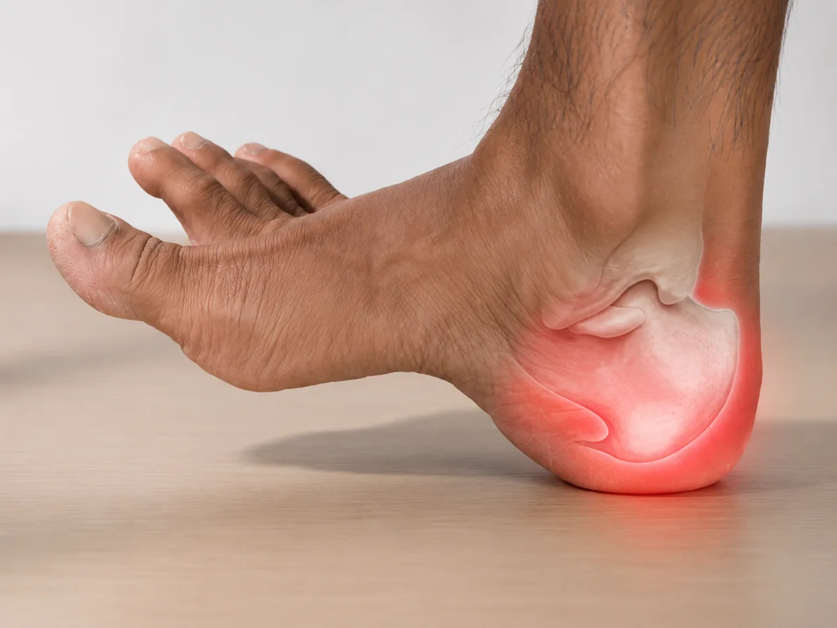 Heel pain — DakshinRehab Moosapet