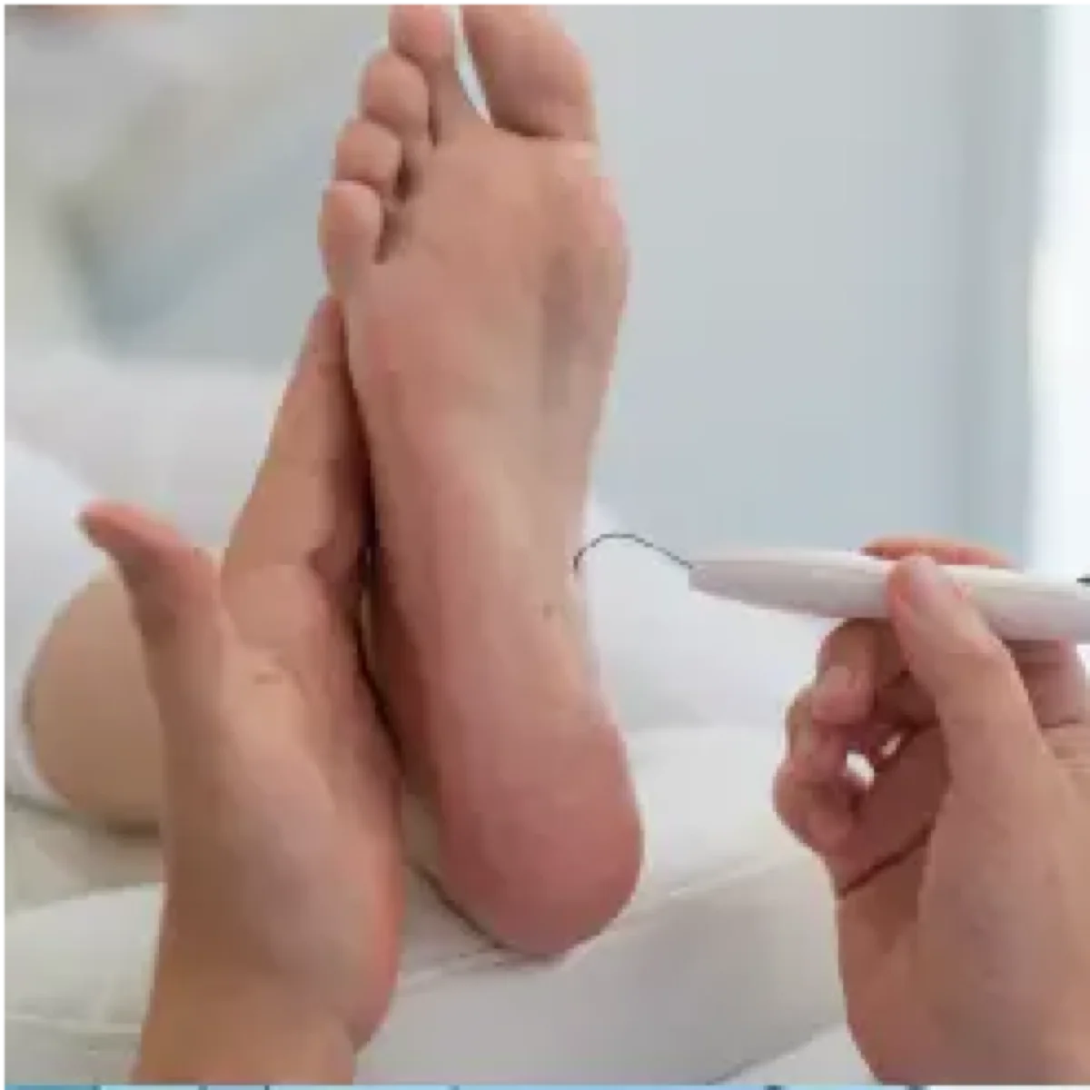 Venous insufficiency treatment with BOA MAX 2