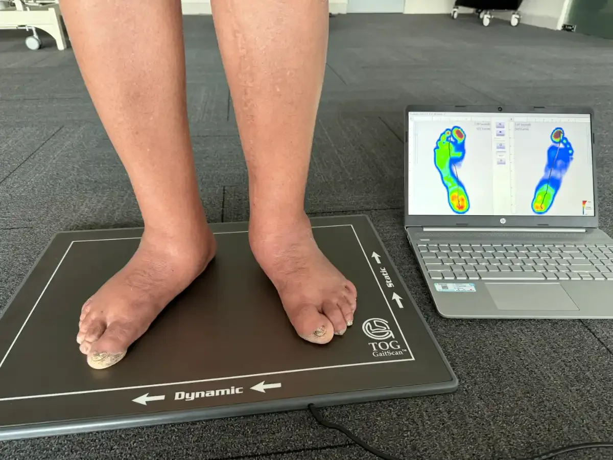 Foot and ankle assessment at DakshinRehab Moosapet, Hyderabad