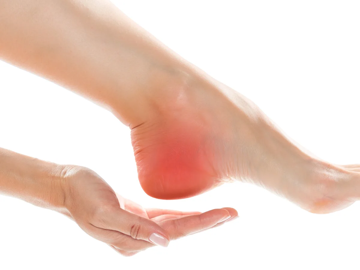 Inflammation of the Achilles tendon at the back of the heel