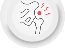 Trochanteric bursitis treatment