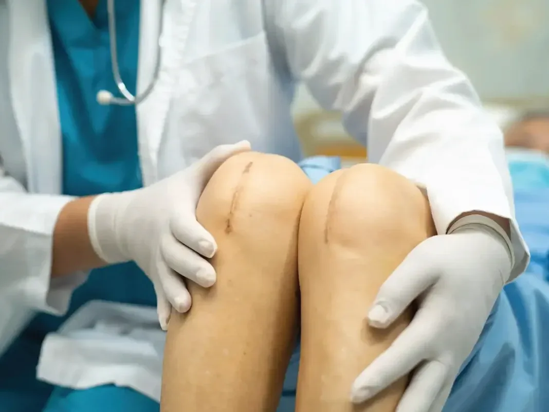 Total knee replacement physiotherapy at DakshinRehab Kukatpally