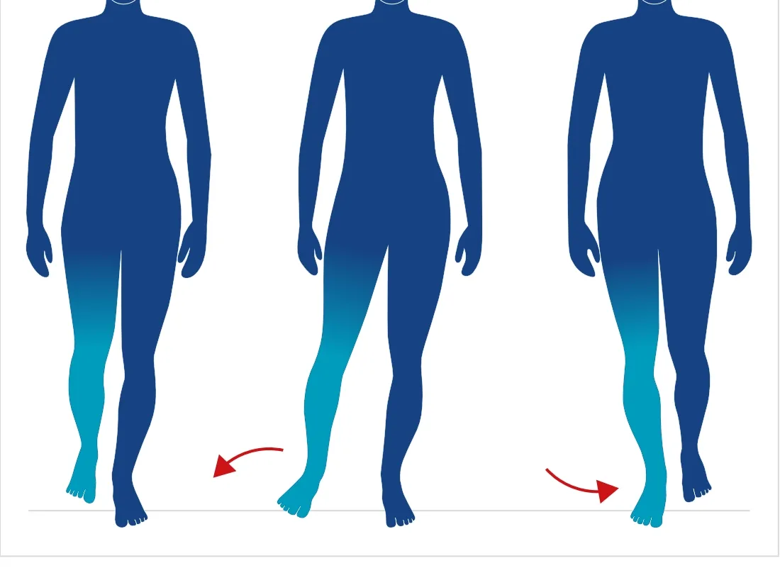 Gait Pattern Classification