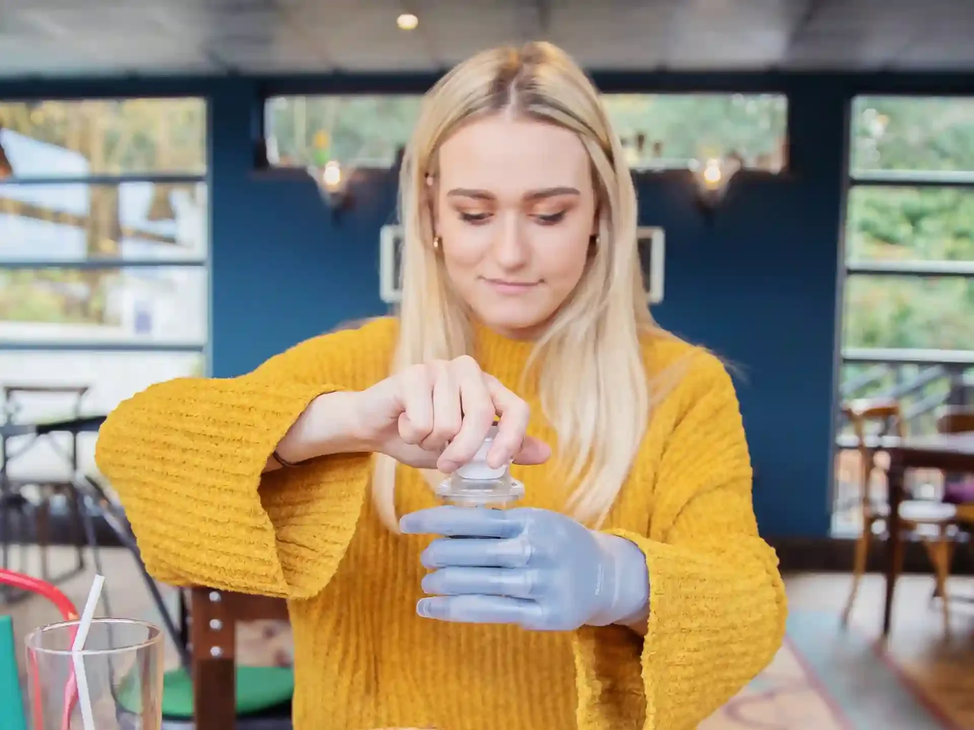 Cosmetic silicone prosthetic hand and upper limb restoration