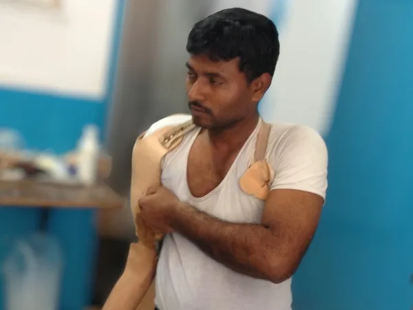 Bionic hand prosthesis in action during daily-living tasks at DakshinRehab Moosapet, Hyderabad