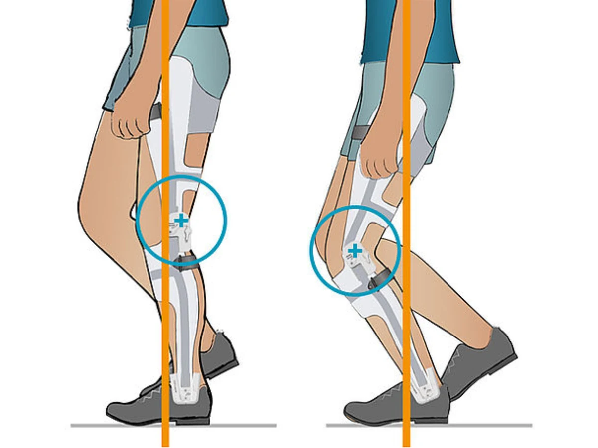 Biomechanical alignment diagram — knee stability vs ground reaction force, assessed at DakshinRehab Moosapet