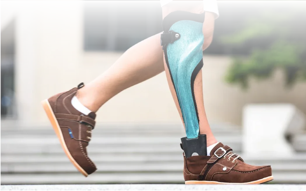 Custom orthotics and bracing at DakshinRehab physiotherapy clinic in Moosapet, Hyderabad