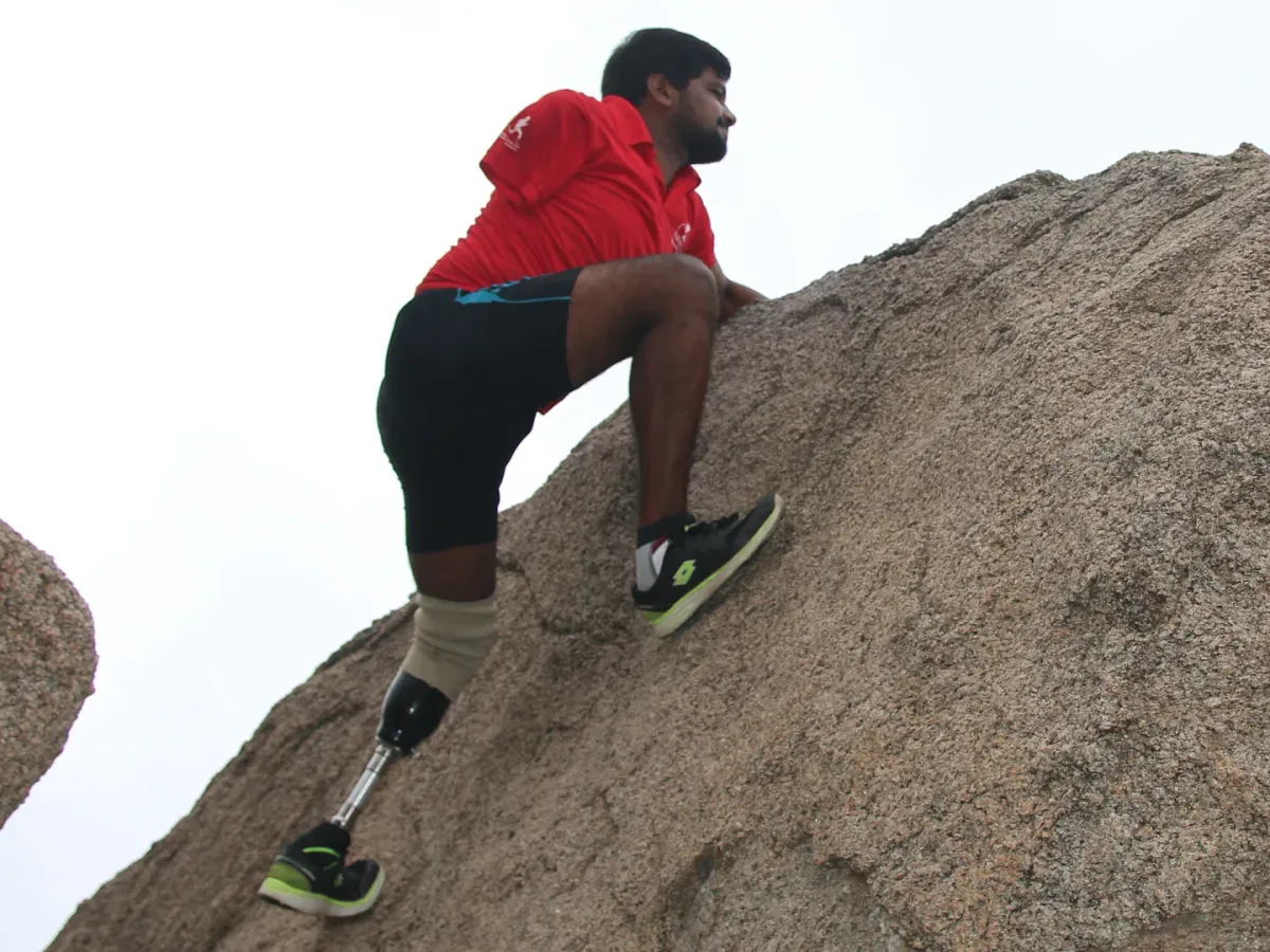 Bilateral below-knee amputee trained by physiotherapist at DakshinRehab Moosapet