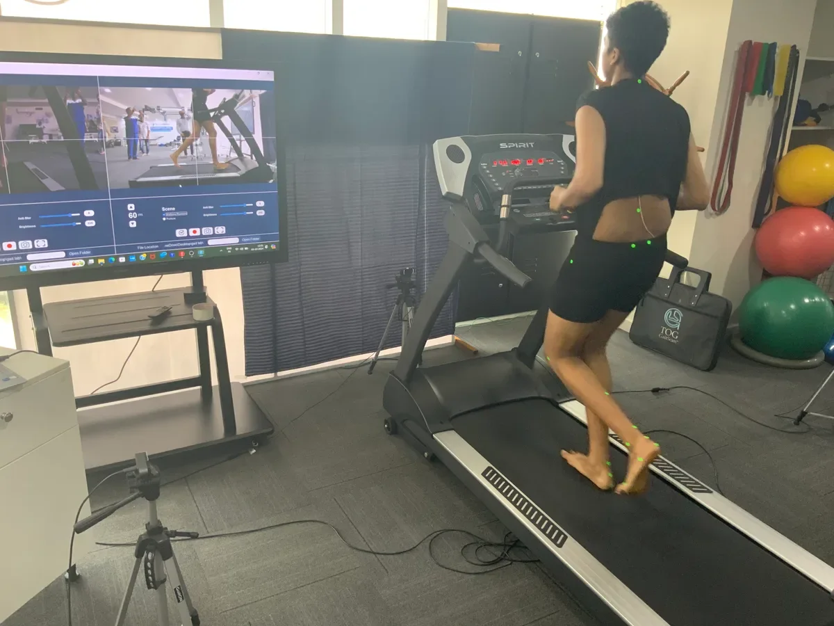 Clinical running gait analysis on the treadmill at DakshinRehab, Moosapet