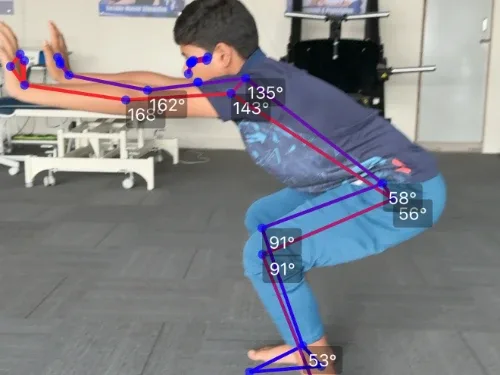 Advanced scoliosis posture and spinal assessment at DakshinRehab, Moosapet, Hyderabad