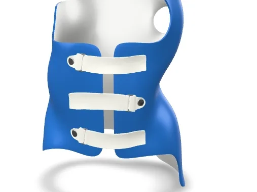 Front view of an asymmetric Chêneau-type three-dimensional scoliosis brace