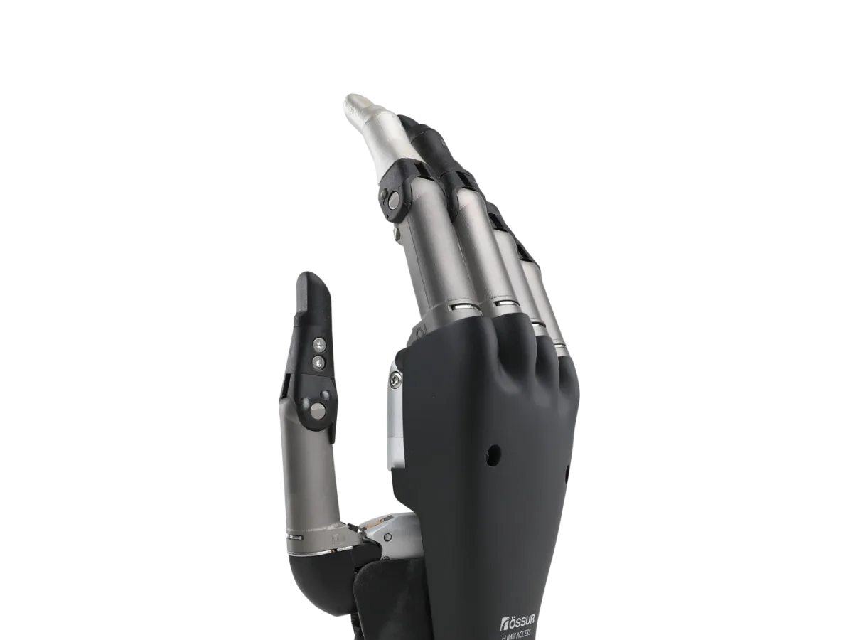 Össur i-Limb myoelectric bionic hand offered at DakshinRehab Moosapet, Hyderabad