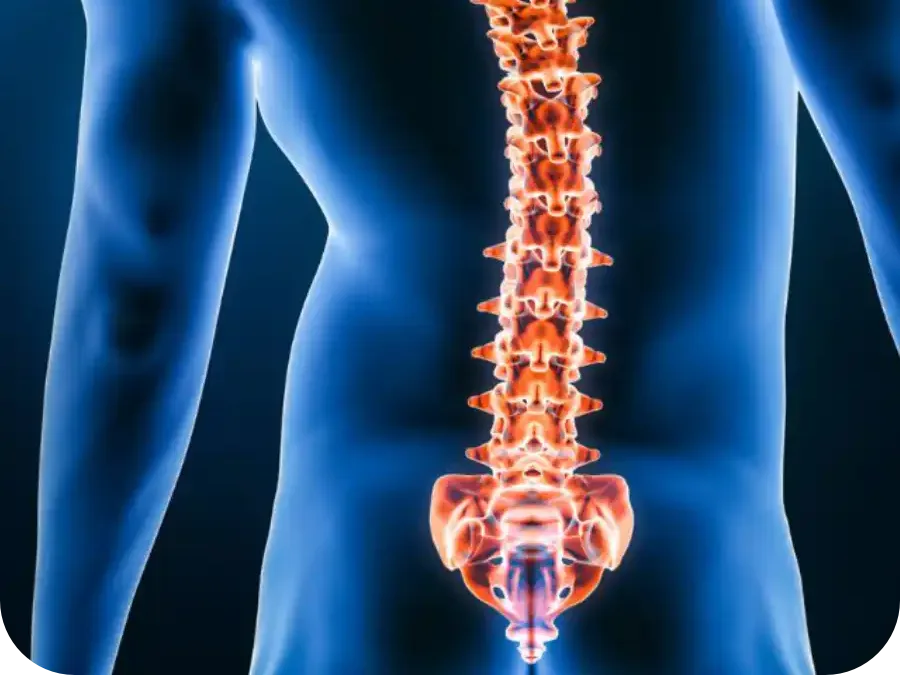 Child with scoliosis showing spinal curvature assessment at DakshinRehab Hyderabad