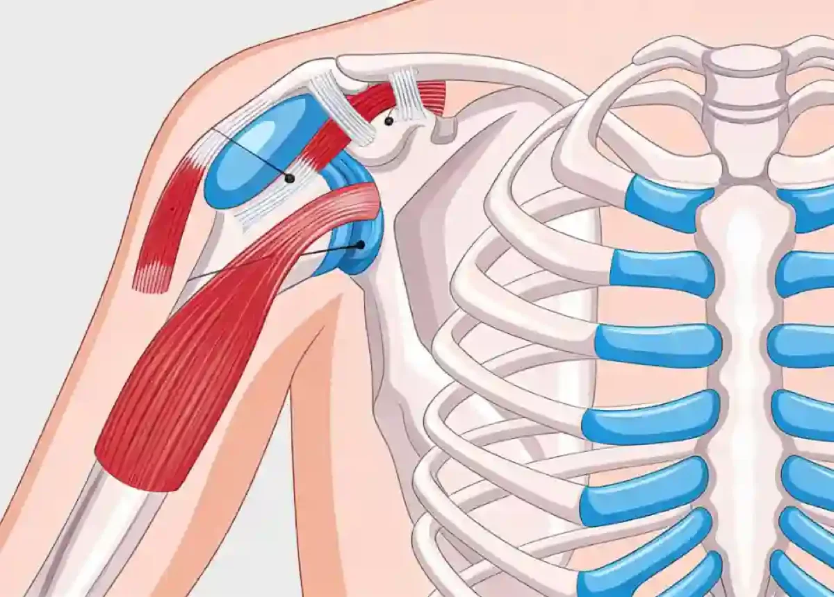 Shoulder Arc Syndrome