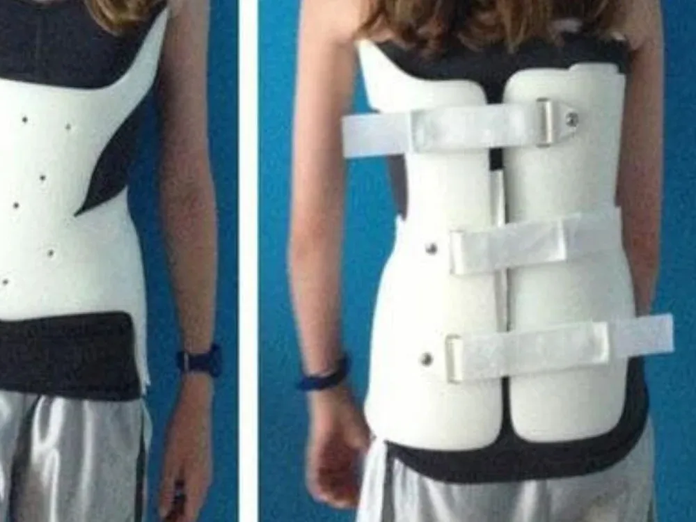 Custom spinal orthotics and bracing