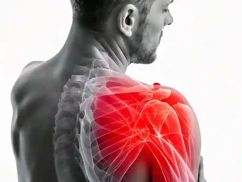 Shoulder pain and impingement — kinesio taping support at DakshinRehab