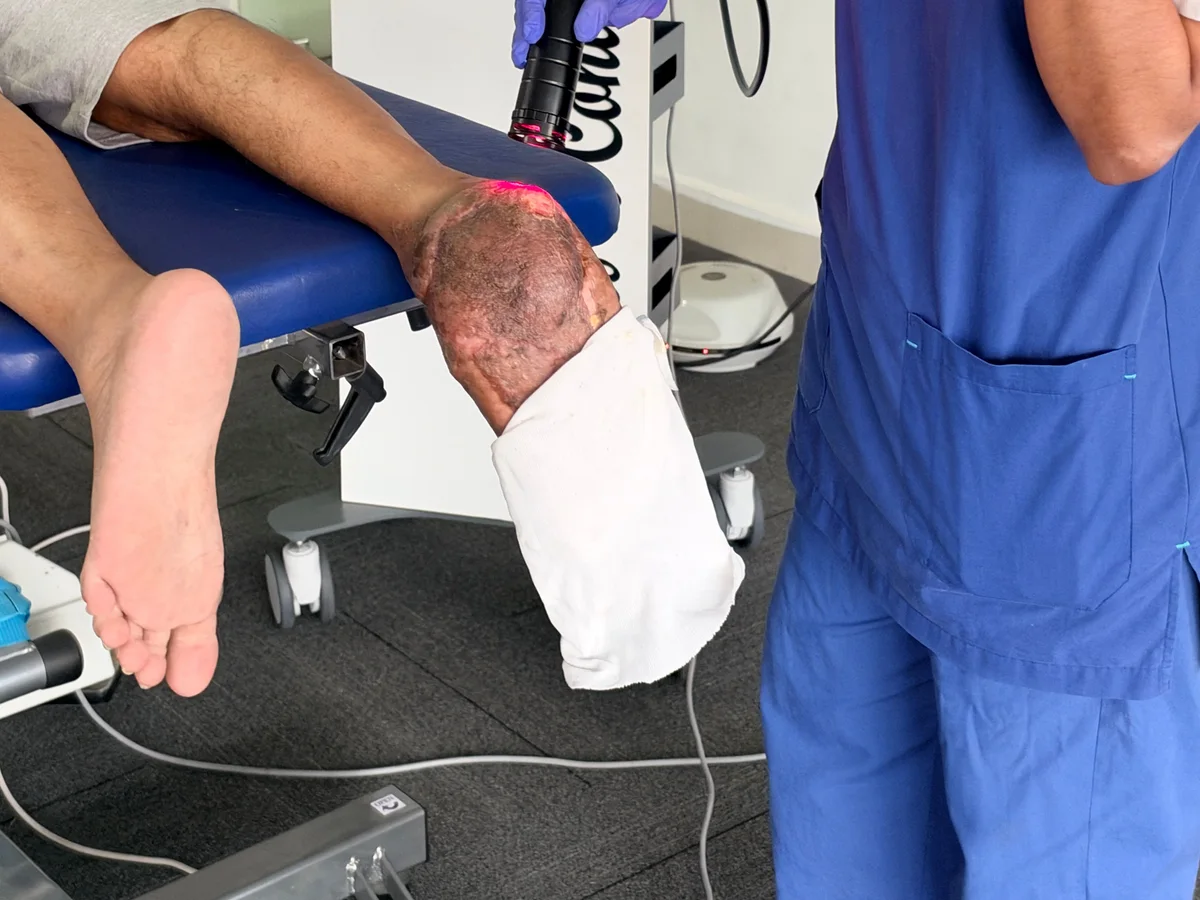 Clinician applying Class IV laser around the foot in the owner-supplied clinic recording photographs