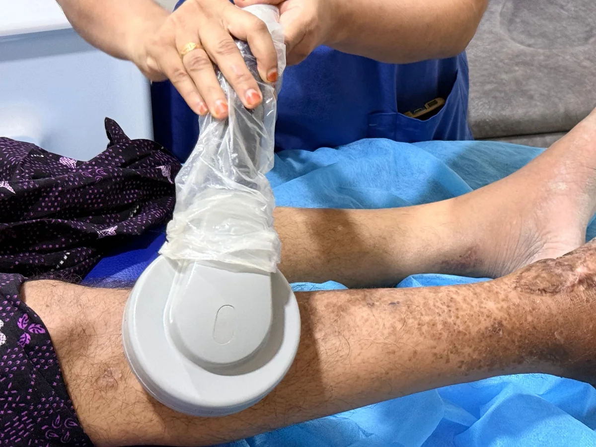 Clinician supports a dressed foot with a magnetic applicator positioned near the lower leg