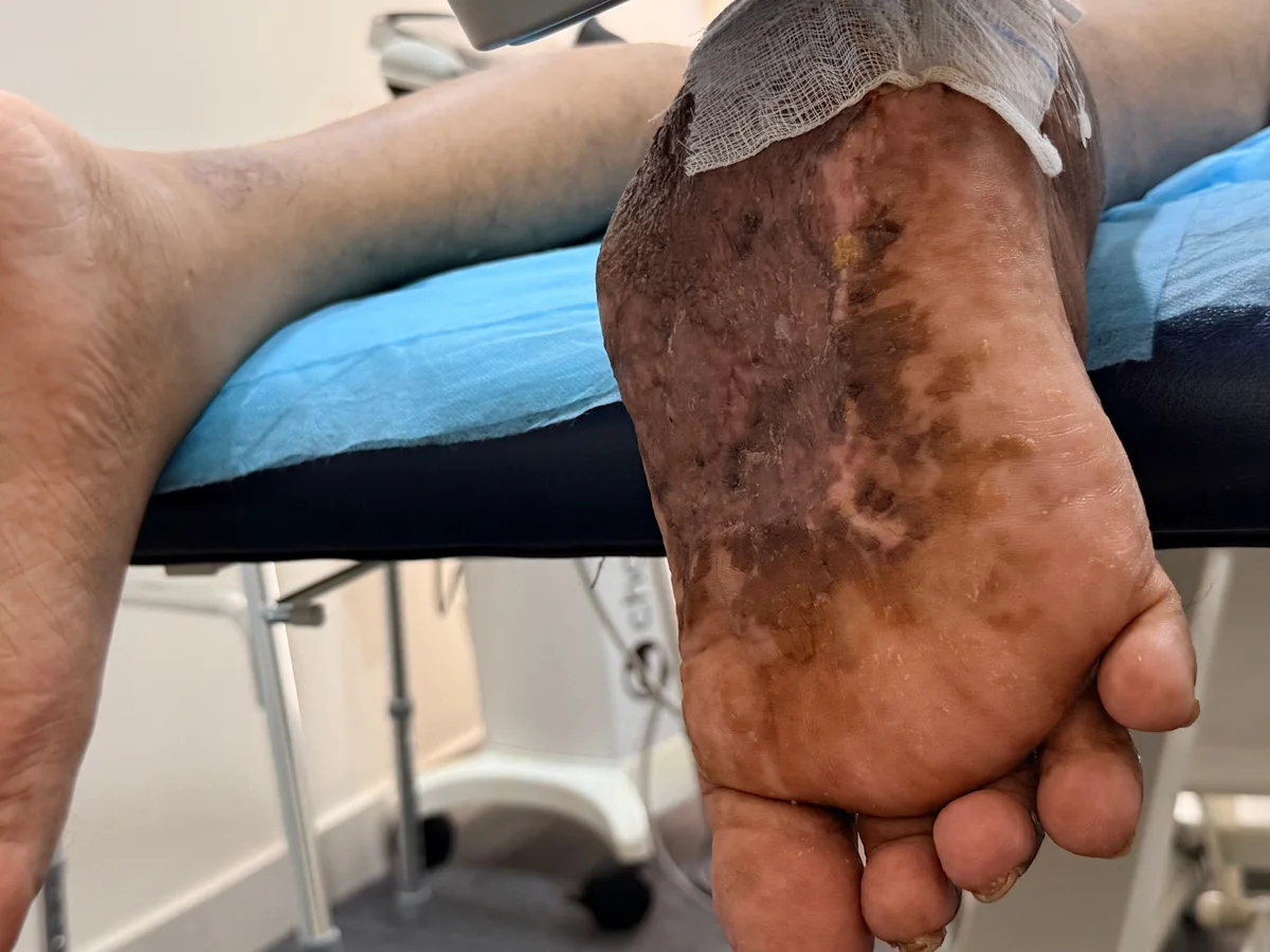 Feet supported on the clinic couch during care; positioning and offloading are individually prescribed