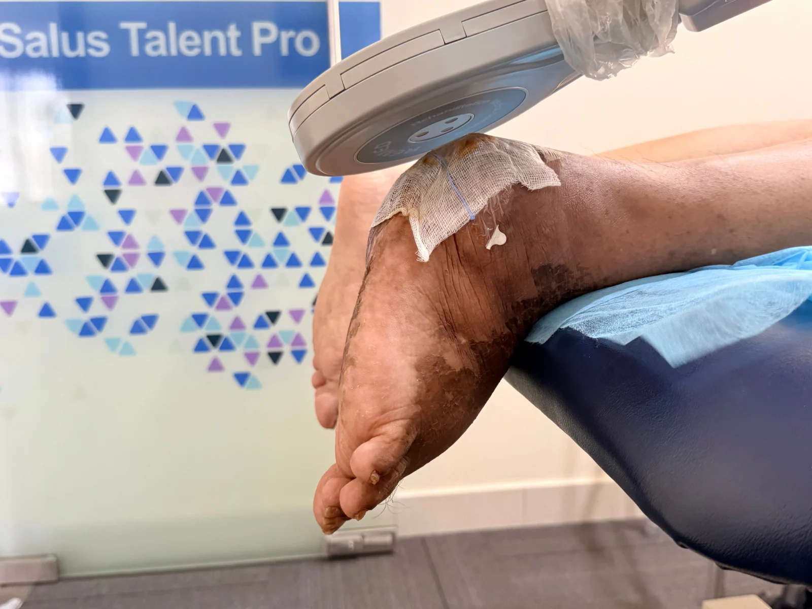 Salus Talent Pro positioned around a protected foot at DakshinRehab; clinic treatment photograph